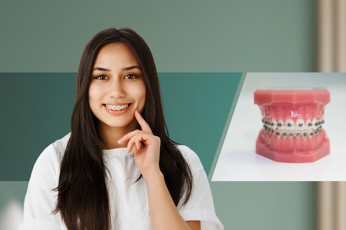 Brace Treatment
