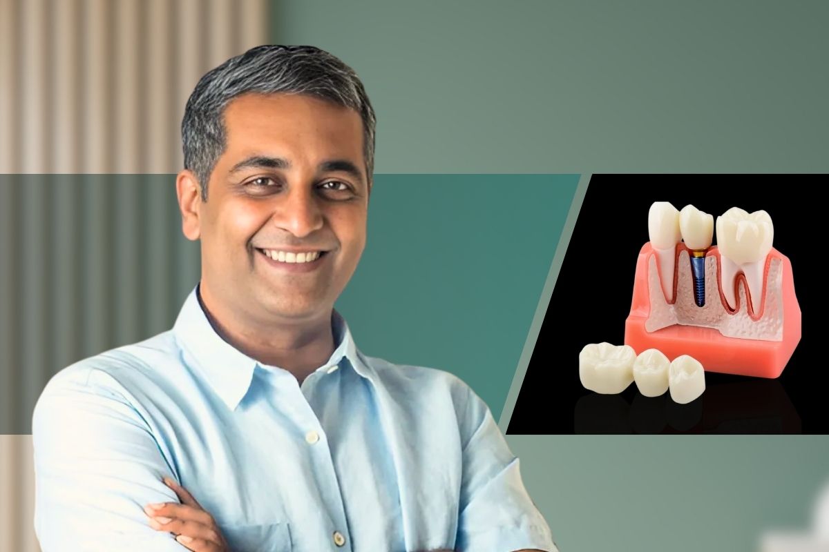 Fixed Teeth In A Day