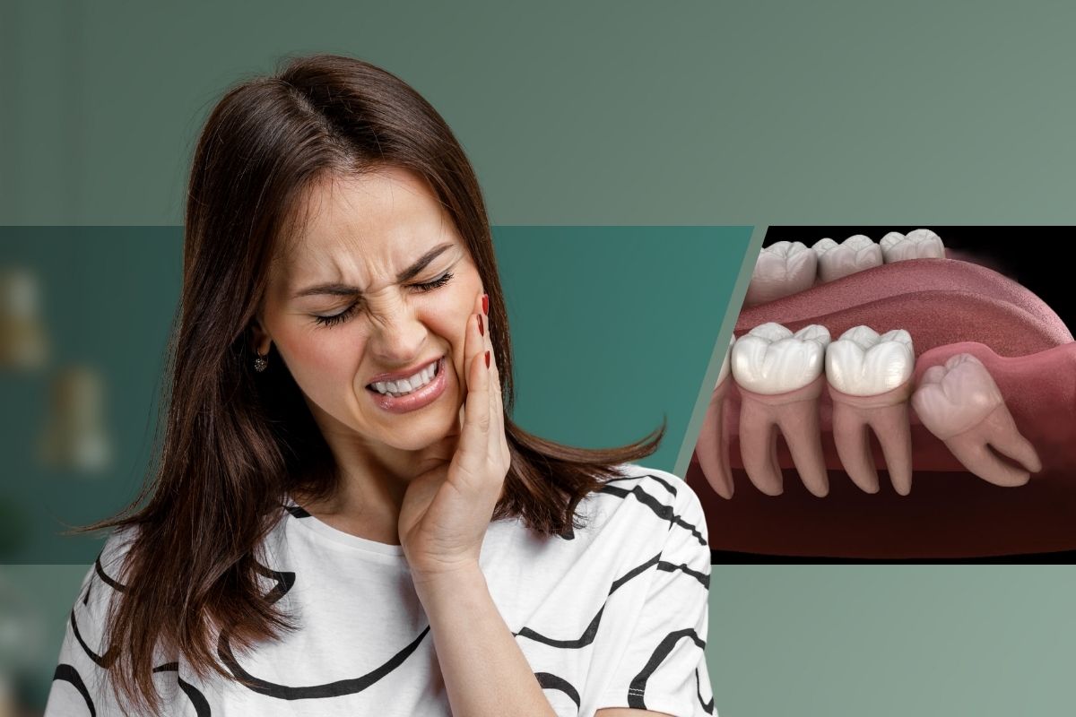 Tooth Extraction