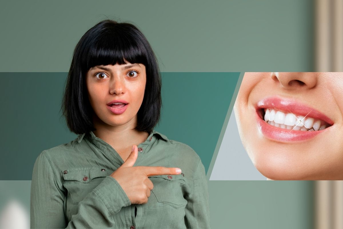 Fixed Teeth In A Day