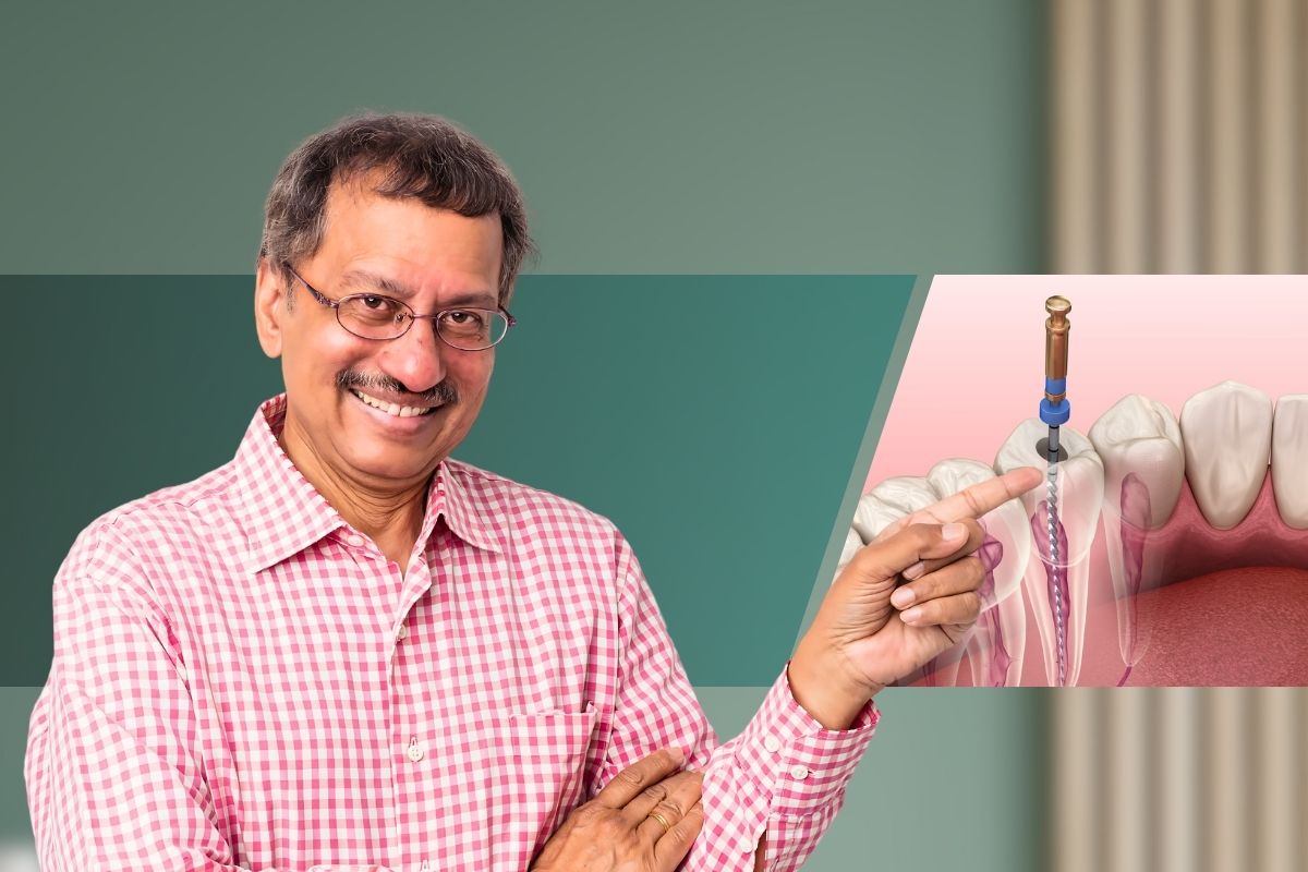 root-canal-treatment